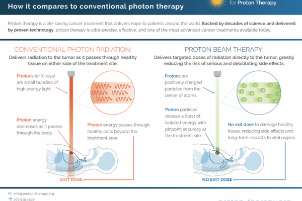 How Proton Therapy Works